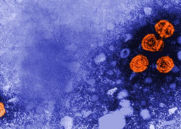 Kanadada mənşəyi bilinməyən hepatit virusu aşkarlandı